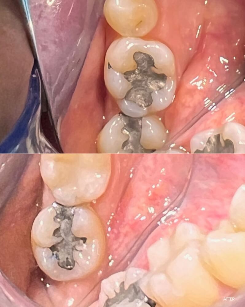 Composite before and after example