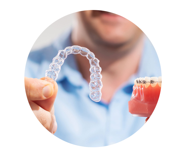 dhca clear aligners