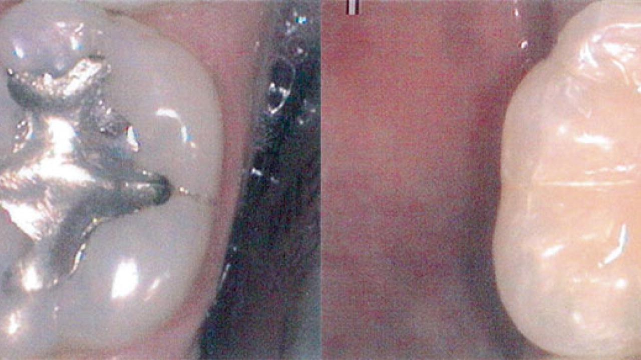 composite2